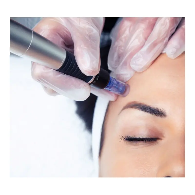 Microneedling