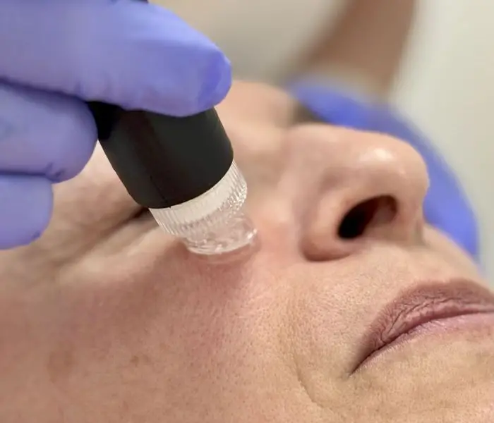 Hydraface